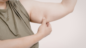 Do GLP-1 Patches Work for Weight Loss