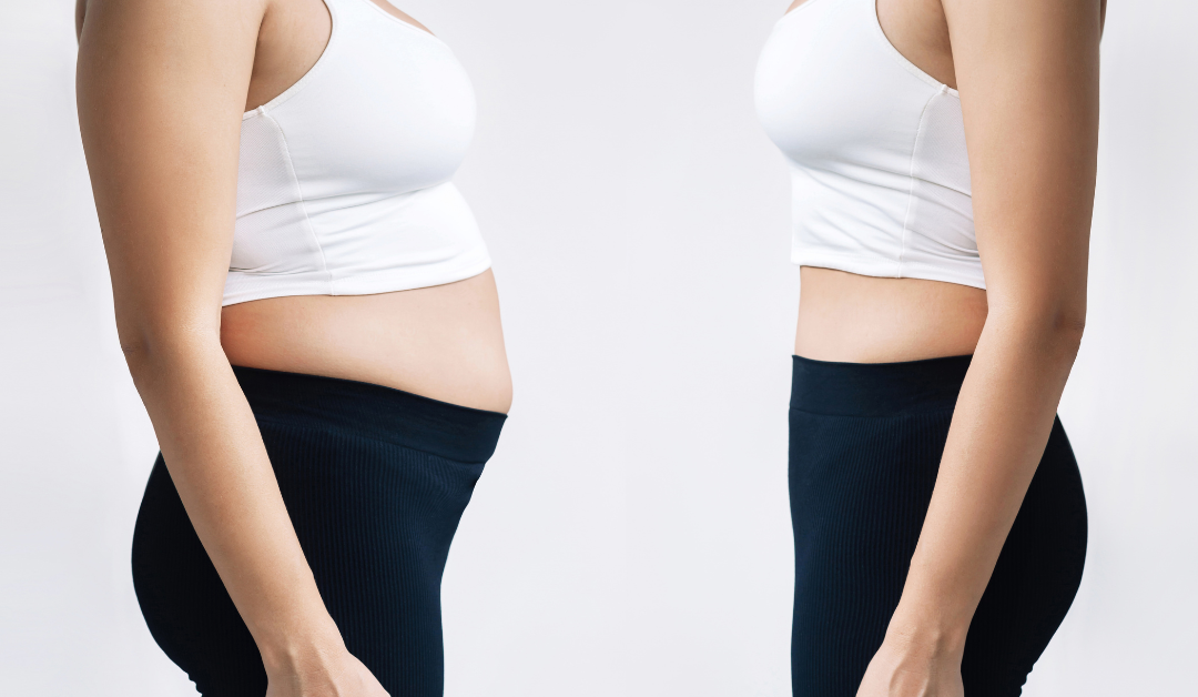 Does BCBS Cover GLP-1 for Weight Loss?