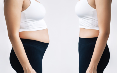 Does BCBS Cover GLP-1 for Weight Loss?