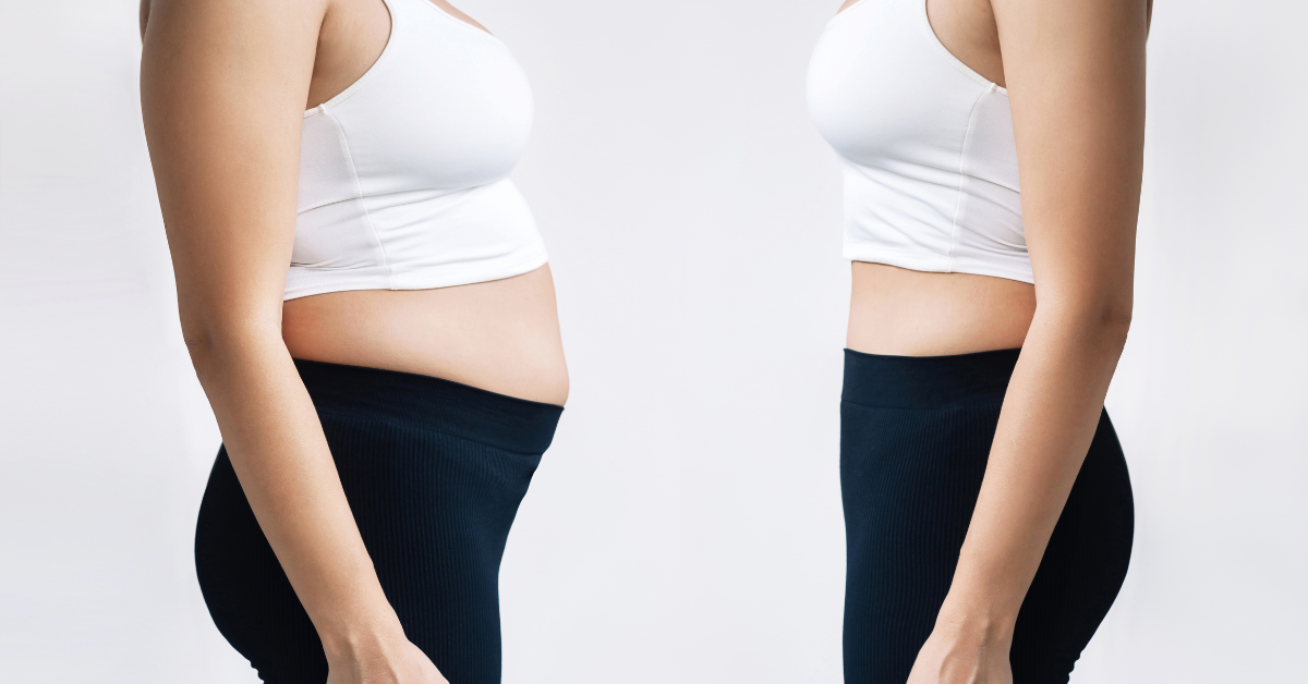 Does BCBS Cover GLP-1 for Weight Loss Does BCBS Cover GLP-1 for Weight Loss