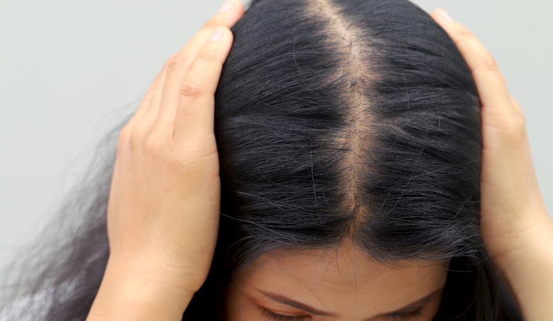Does GLP-1 Cause Hair Loss? What the Research Actually Says