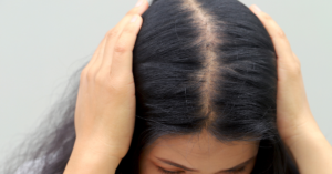 Does GLP-1 Cause Hair Loss What the Research Actually Says