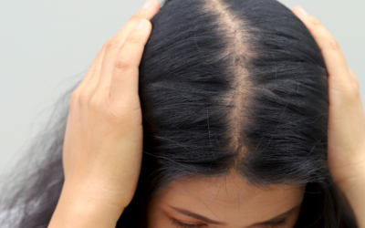 Does GLP-1 Cause Hair Loss? What the Research Actually Says