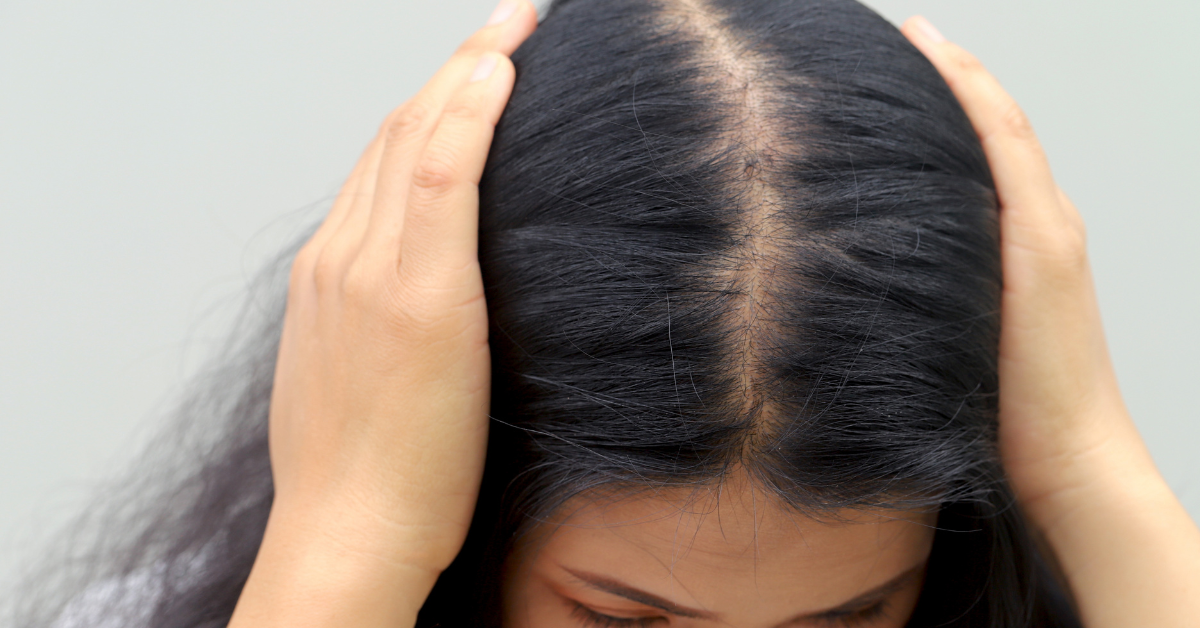Does GLP-1 Cause Hair Loss What the Research Actually Says